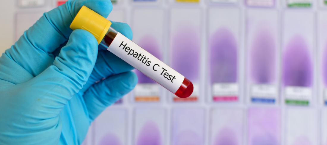 testing for hepatitis c