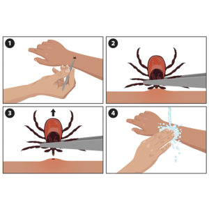 how to remove a tick quickly