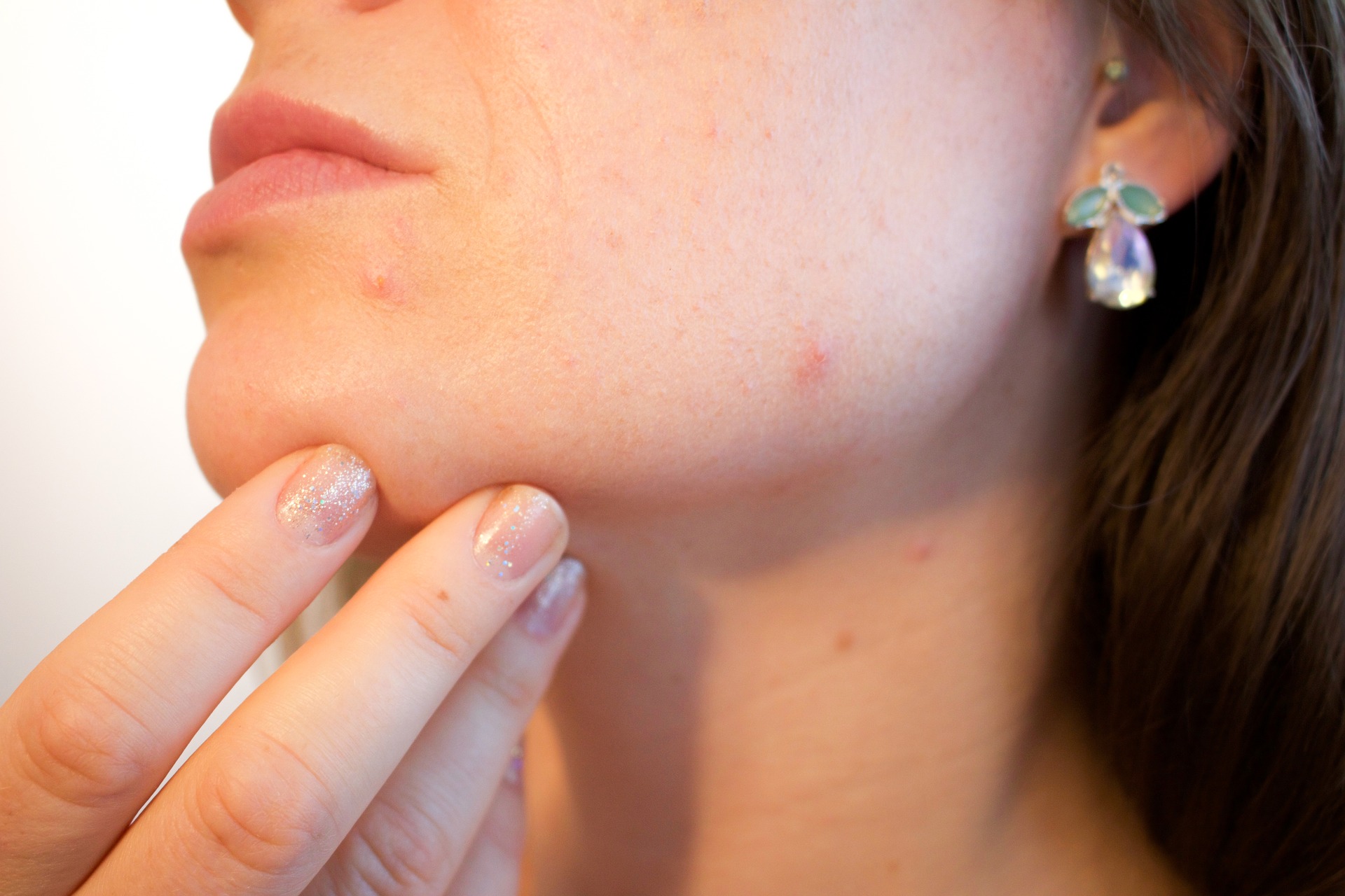 person touching a face with red spots on it