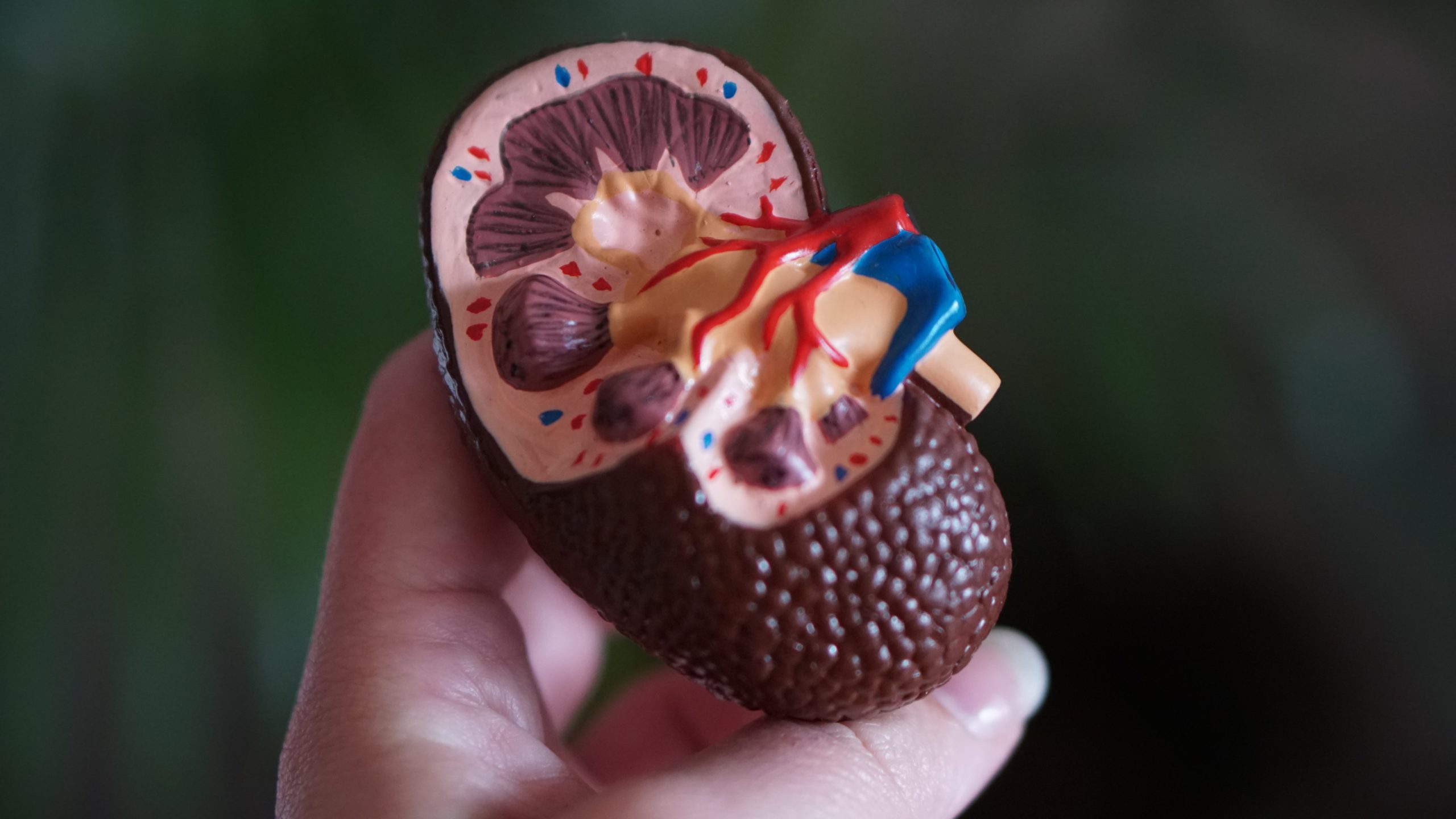 anatomical kidney model premier medical group hudson valley